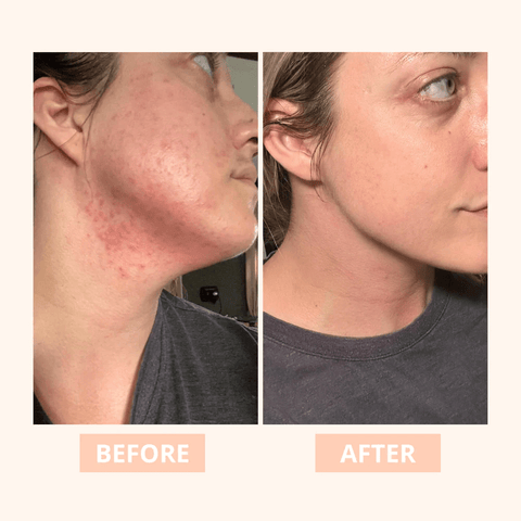 Truly Lifestyle Ageless 1% Retinol Serum – Anti - Aging Night Treatment - The Local Space