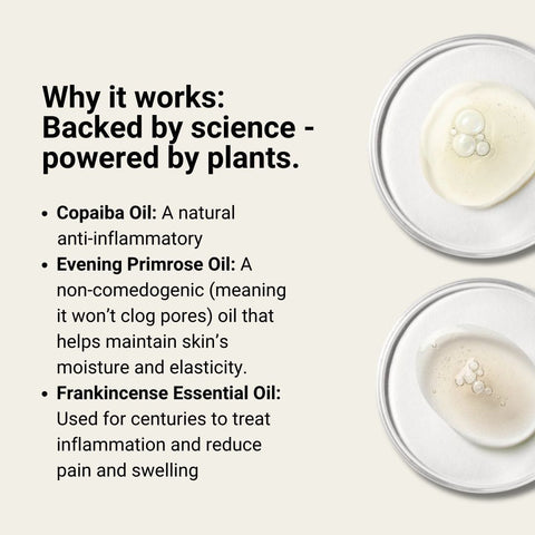 After Flow | Anti-Inflammatory Bath & Body Oil - The Local Space