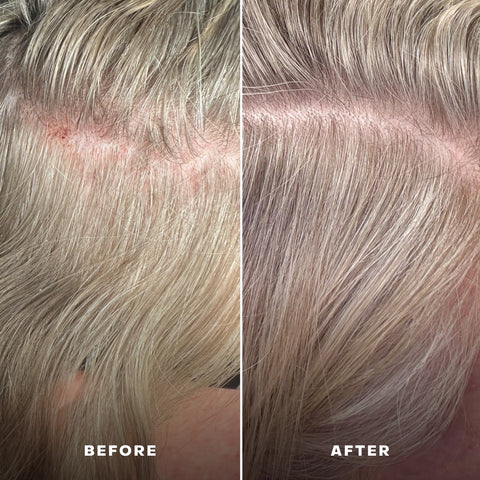 Everboost Multi-Peptide Scalp Serum