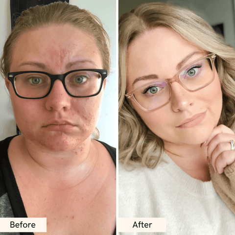 Truly Brightening Vitamin C Serum – Hyperpigmentation & Glow Booster - The Local Space