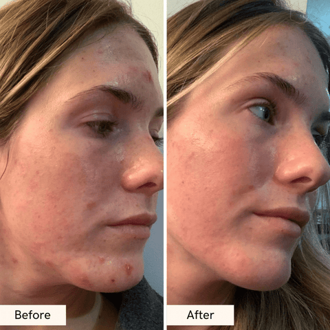 Truly Cleansing Facial Cleanser – Hydrating Cream Cleanser with Squalane - The Local Space