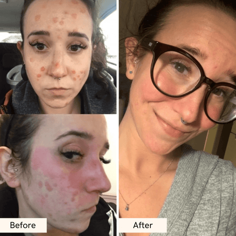 Truly Moisturizing Face Cream – Rich Hydrating Cream for Dry Skin - The Local Space